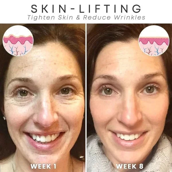 Last Day Promotion 70% OFF - đ„Botox Face Serum