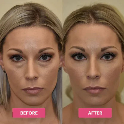 LAST DAY BUY 1 GET 1 FREEREVIVE TIRED EYES -HYDRATING & ANTI-WRINKLE EYE BALM