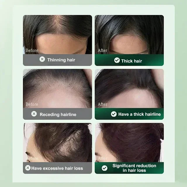 🏆Limited time offer⚡ Ant-Hair Loss And Hair Growth Solution