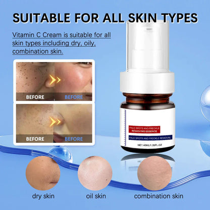 🔥Vitamin C Whitening Freckles Face - The Japanese Geisha's "Lost Secret" for Porcelain Skin