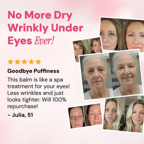 LAST DAY BUY 1 GET 1 FREEREVIVE TIRED EYES -HYDRATING & ANTI-WRINKLE EYE BALM