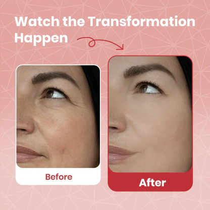 LAST DAY BUY 1 GET 1 FREECentella Asiatica Cream (All-In-One)